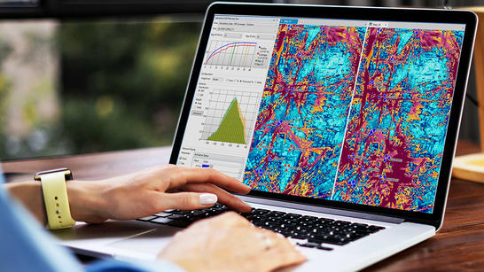 Planet ACP use case